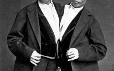 The Controversial Life of the First Conjoined Twins