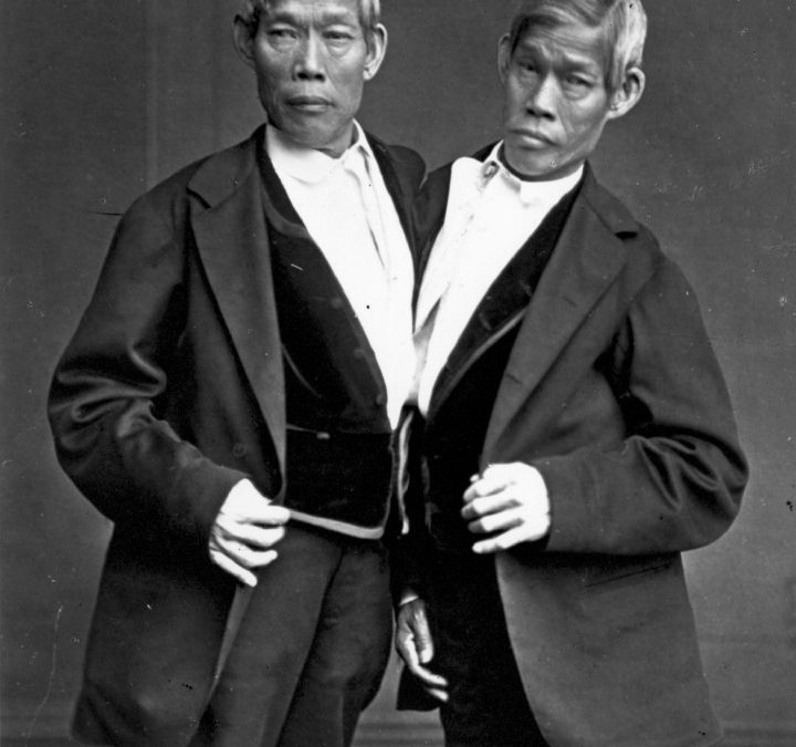 The Controversial Life of the First Conjoined Twins