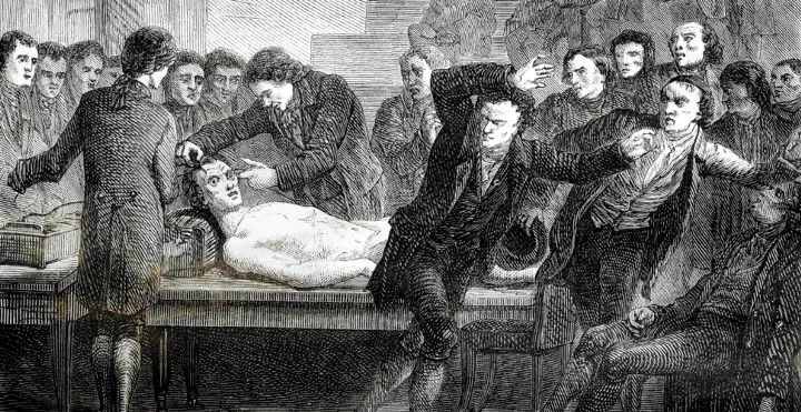 1800s Real-Life Frankenstein Experiment of Resurrecting a Dead Corpse