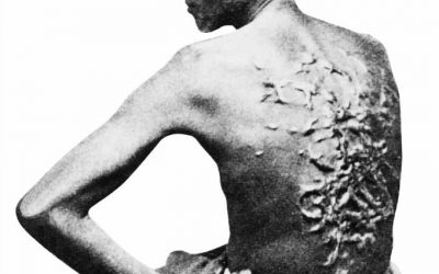 The Myth of Black People Not Feeling Pain Is Still Believed to This Day