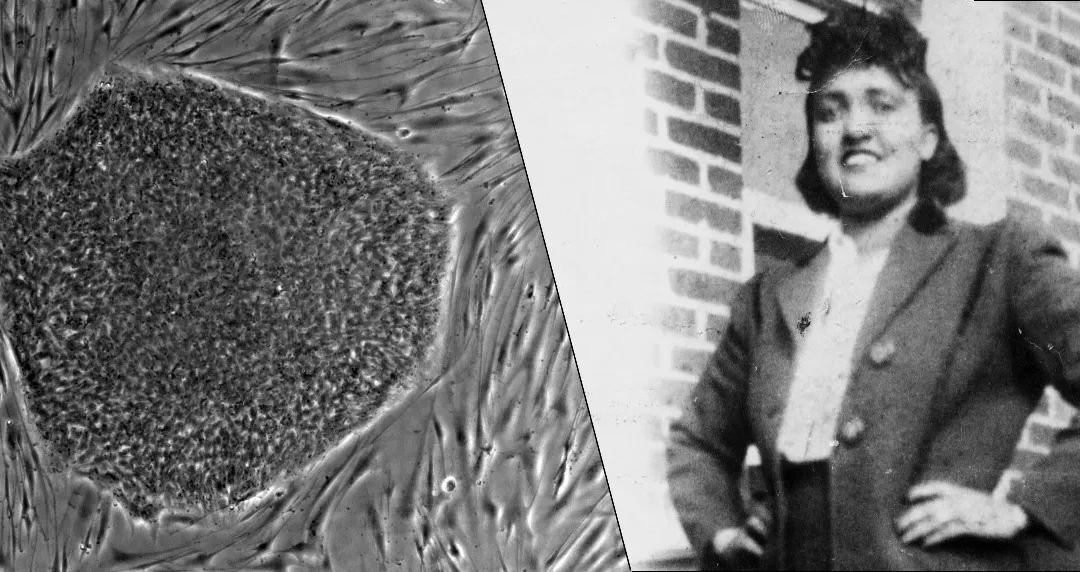 The Immortal Cells of Henrietta Lacks Which Saved Millions