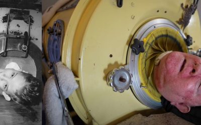 Living in an Iron Lung for Over 70 Years