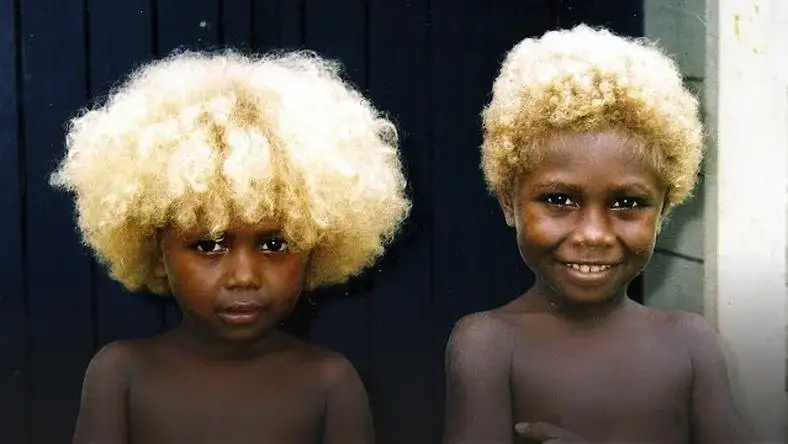 The Interesting History Of Black People With Blonde Hair | History of  Yesterday